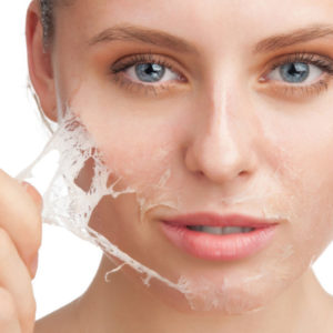 Peeling Chimico a catanzaro